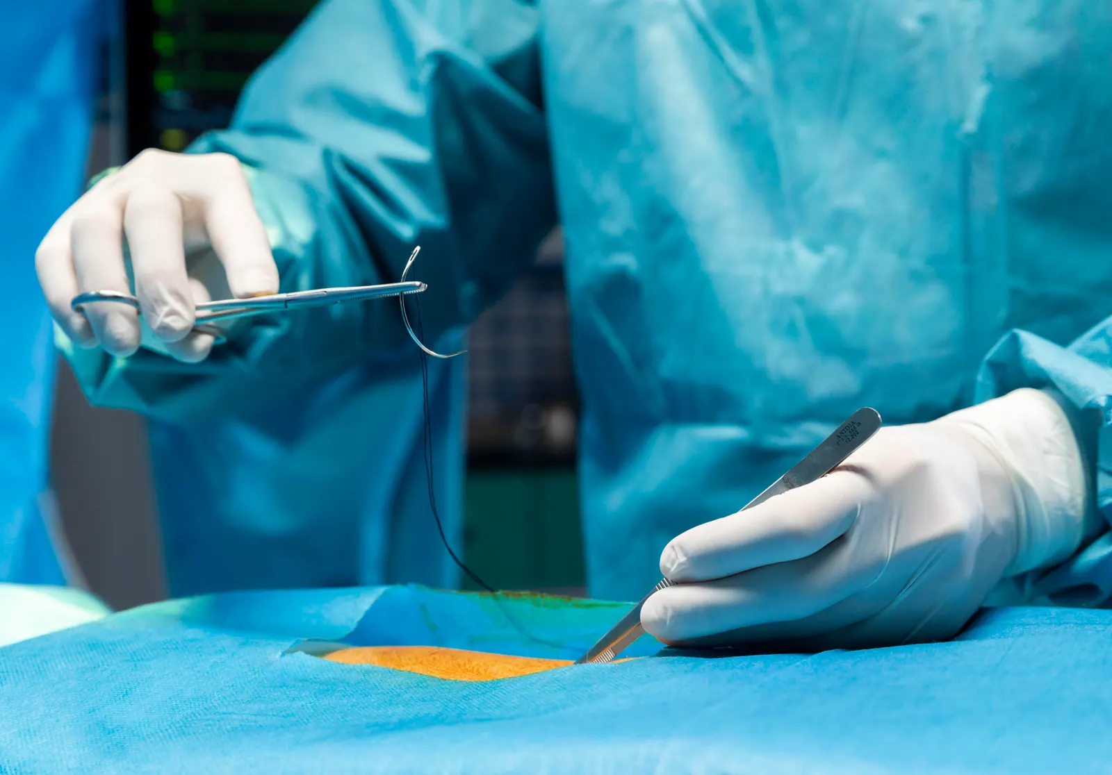 Detalhe de procedimento cirúrgico